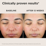 EltaMD UV Skin Recovery Red Color Correcting - Green Tinted