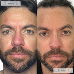 Omnilux Contour Men
